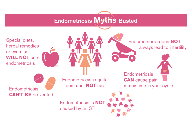 Endometriosis operación