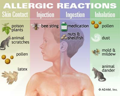 Allergy