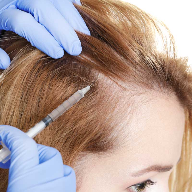 Treatment for Alopecia at Philadelphia Homeopathic Clinic by Dr. Tsan