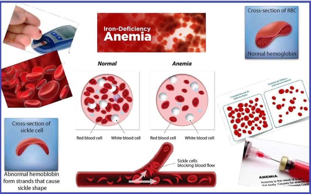 Homeopathic treatment for low hemoglobin