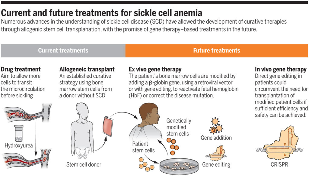 Treatment for Sickle cell anemia