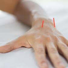 Joints pain acupuncture