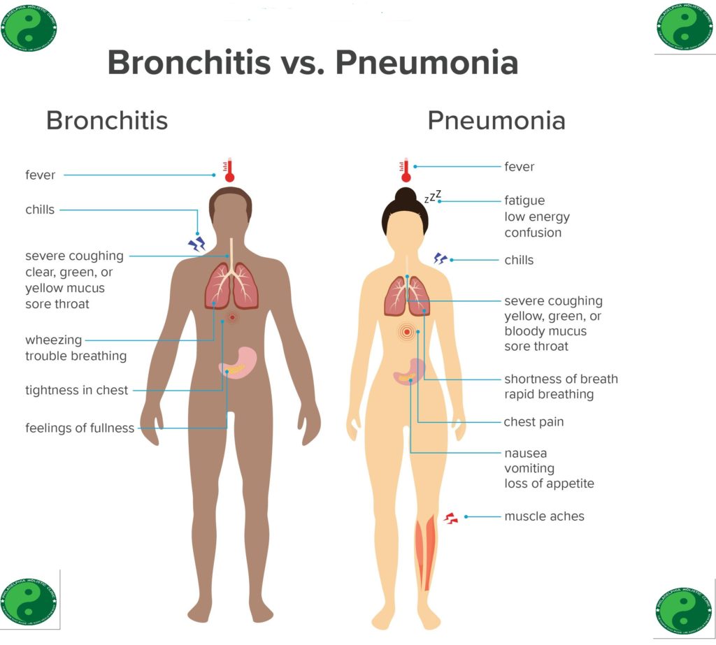 Bronchitis vs Pneumonia