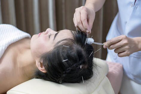 Acupuncture treatment