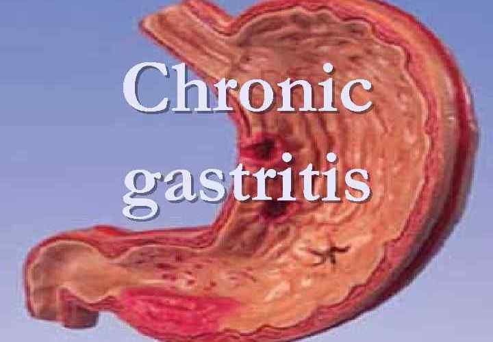 Tratamiento gastritis cronica atrofica