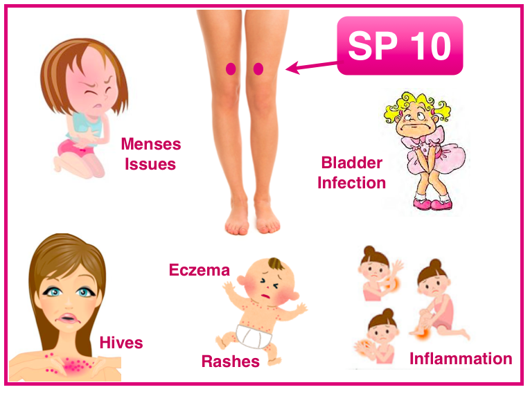 SP10 Acupoints for hives