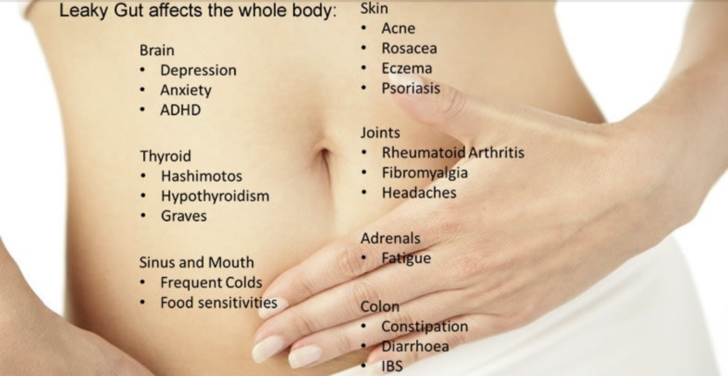 Symptoms of Leaky gut