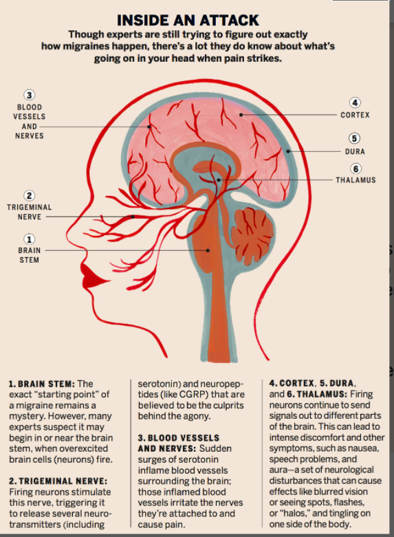 Migraine mechanism