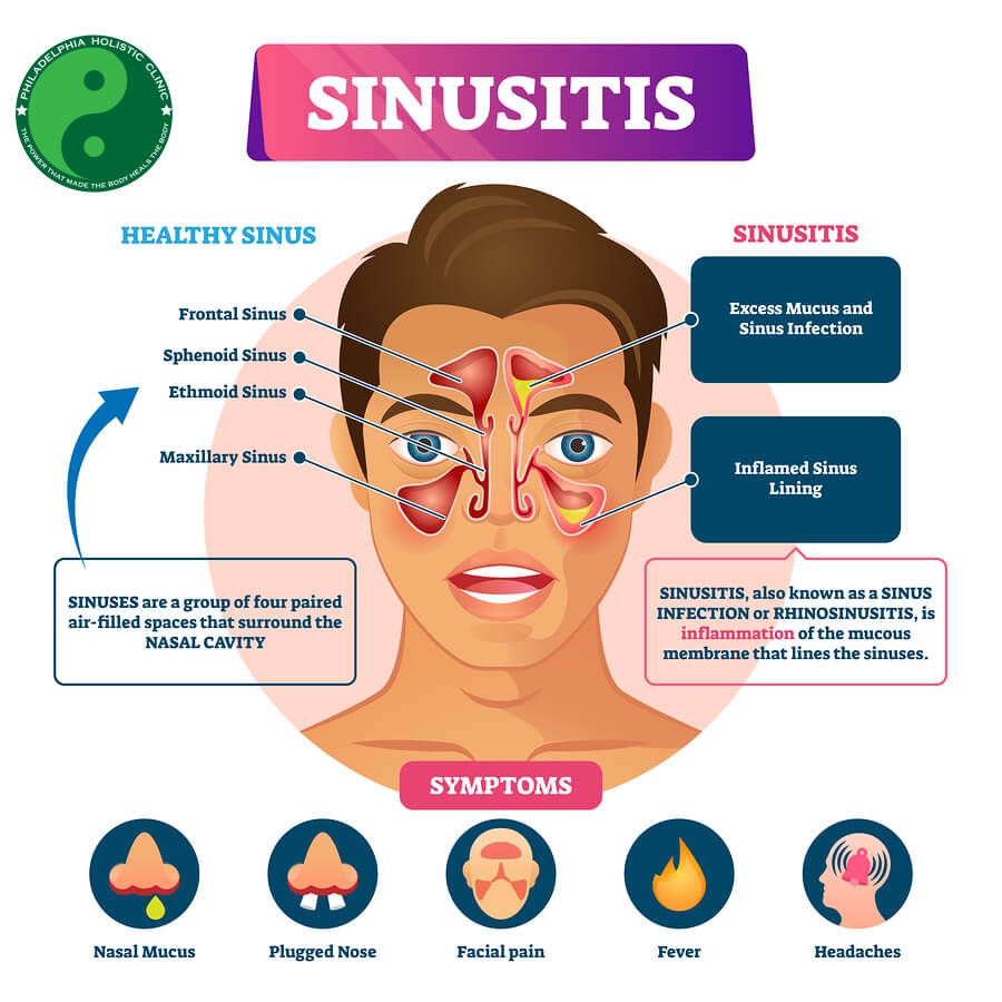 Symptoms of sinus infection