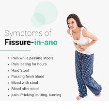 symptoms of anal fissure