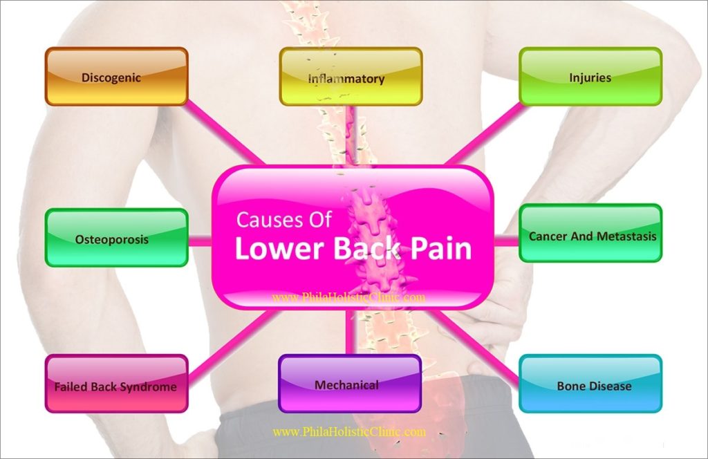 Causes of low back pain