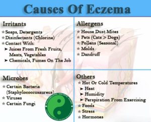 Treatment for eczema at Philadelphia Homeopathic Clinic by Dr. Tsan & Co