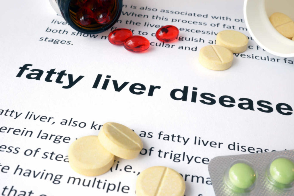 Fatty liver treatment 
