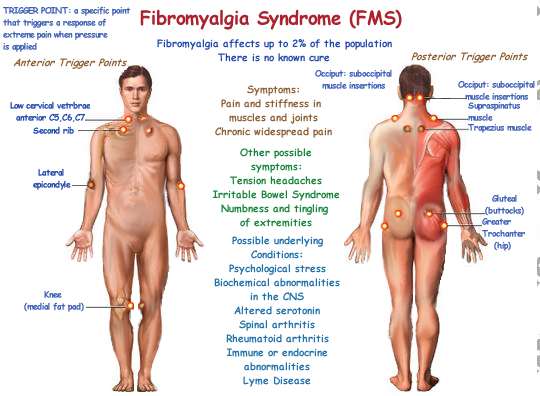 Fibromyalgia Sydrome