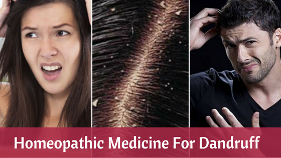 Homeopathic remedies for dandruff