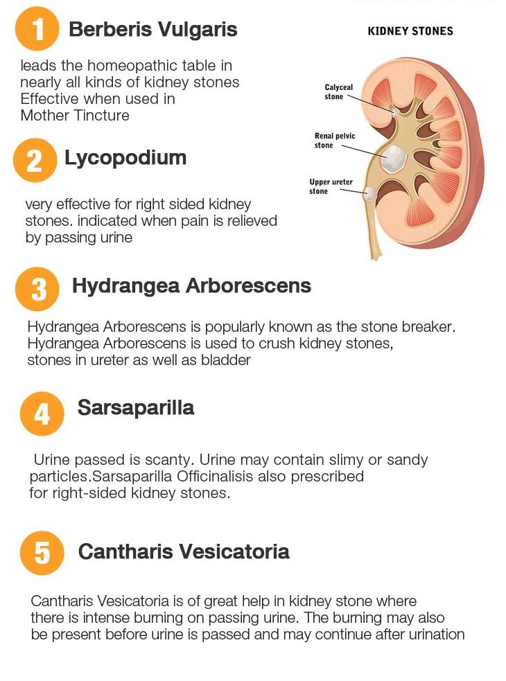 Kidney Stones Homeopathic Treatment