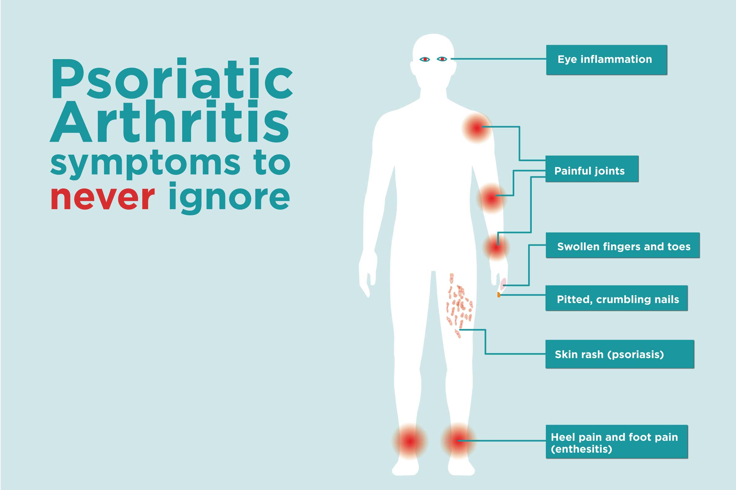 Psoriatic Arthritis symptoms