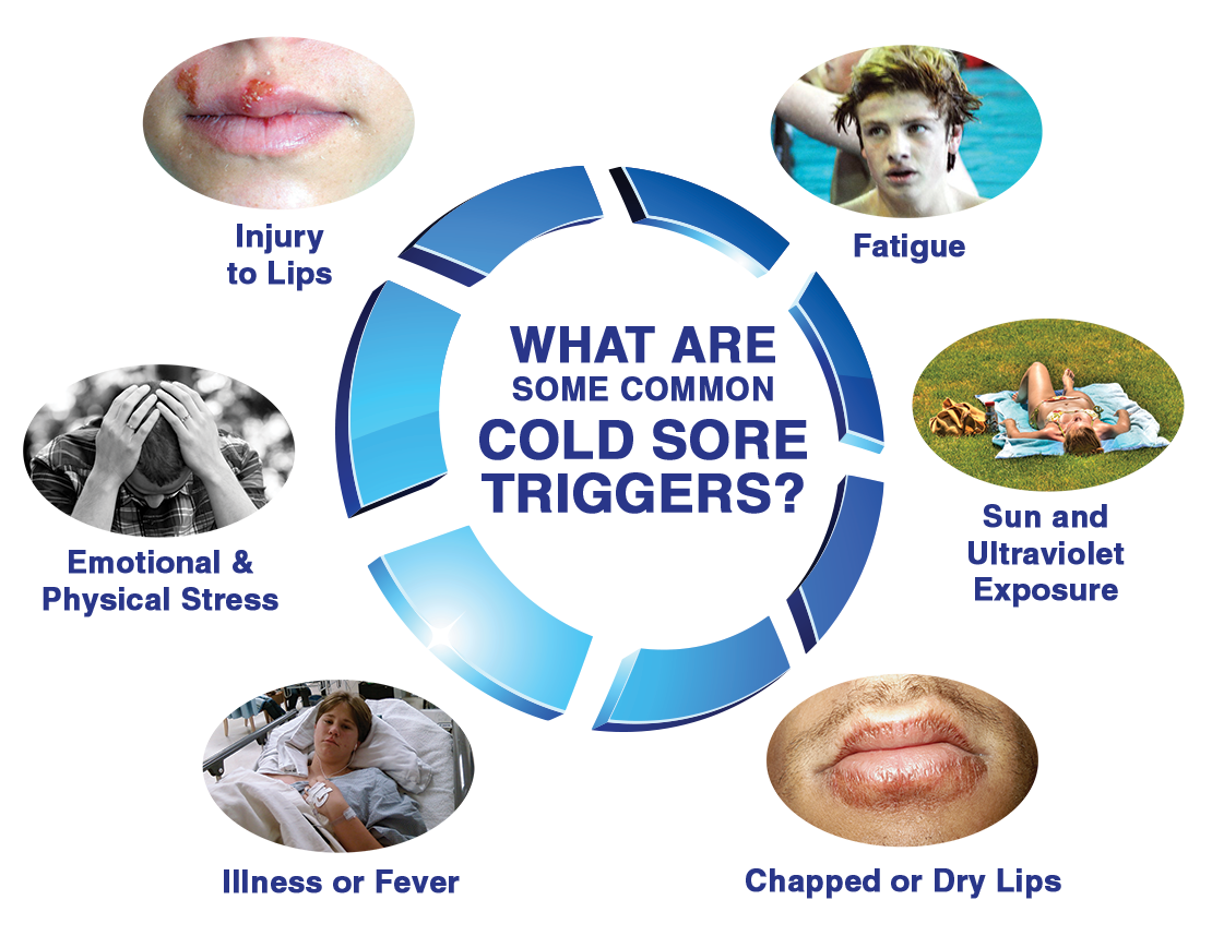 causes of cold sores