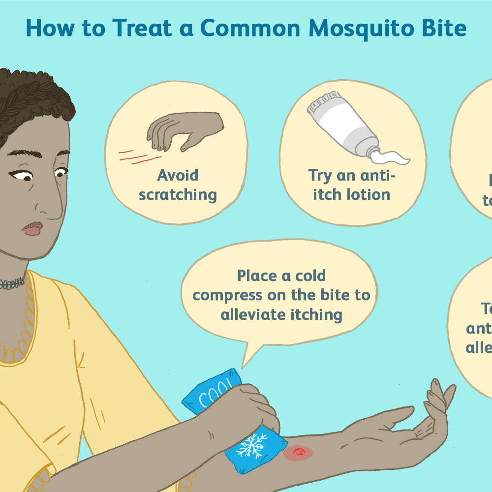 Treatment for mosquitos bitesTreatment for mosquitos bites