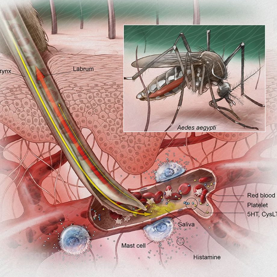 Mosquitos Bites Prevention Philadelphia Homeopathic Clinic Mosquitos Bites Prevention Philadelphia Homeopathic Clinic
