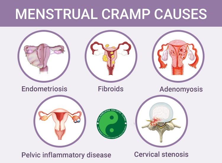 Menstrual Cramps Causes